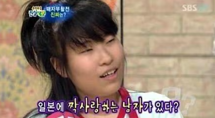  몰라보게 달라진 개그우먼! 벤츠 한 대값 성형비 고백까지!
