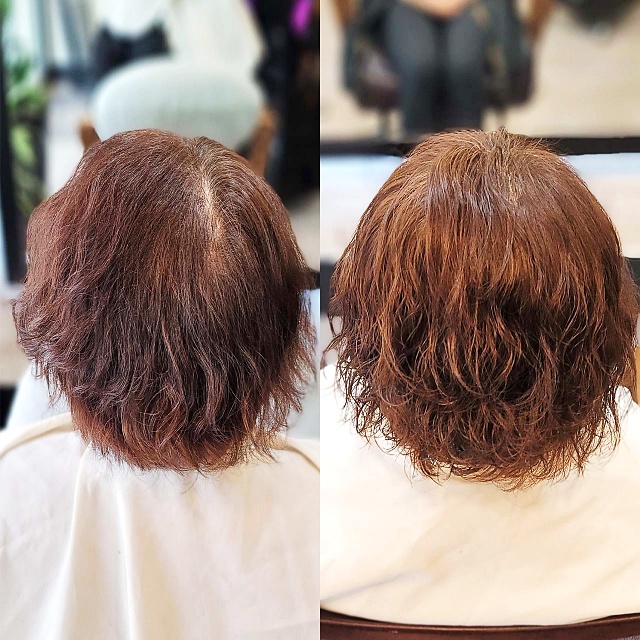  수원 링거펌 잘하는 곳 찾으시나요? 쩍 갈라지는 가르마 없애고 풍성한 볼륨으로 변신이 가능할까요?