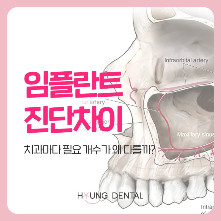  영통 임플란트, 가는 곳마다 진단이 다른 이유?