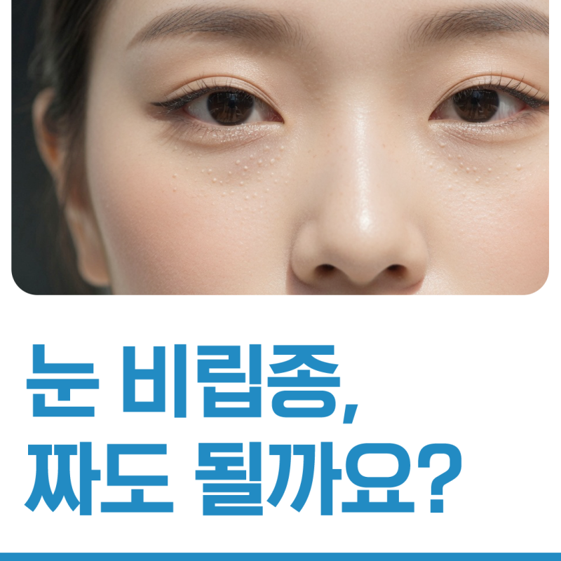 눈 비립종, 짜도 될까요?