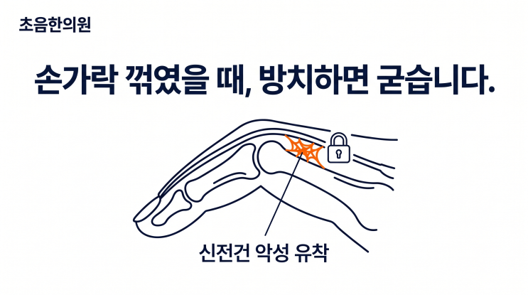  손가락 부상 인대 파열 후 안 펴질 때, '악성 유착' 원인 치료