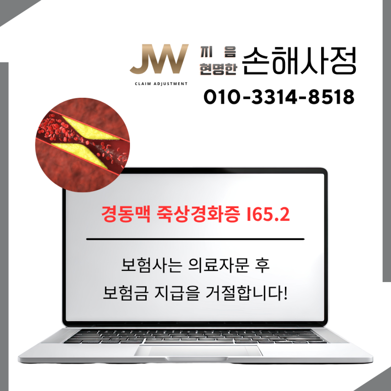 경동맥 죽상경화증, 어떤 보험사는 I70이라 주장하네요?