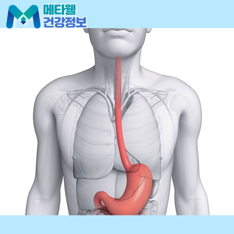 피부에 반점이 생기면 식도암? 식도암 초기증상부터 검사, 치료까지