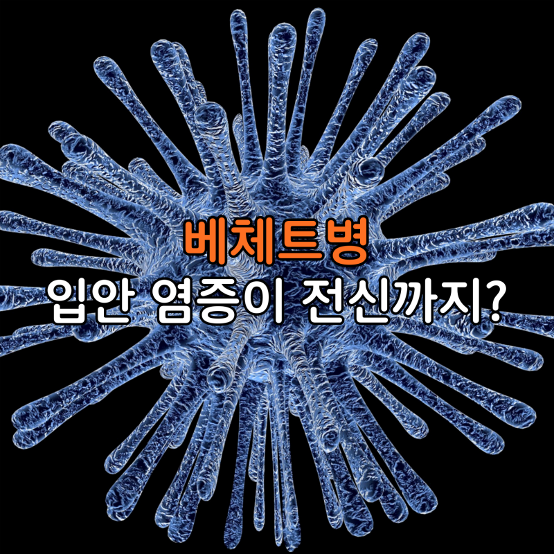 입안 염증이 전신으로 번지는 이유! 베체트병 원인과 면역 관리 포인트