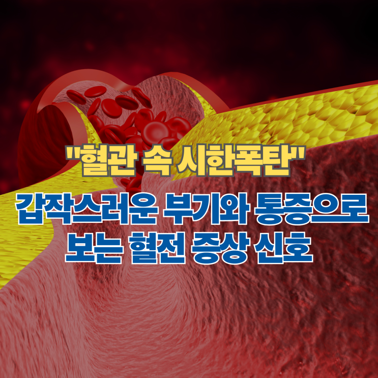  "혈관 속 시한폭탄" 갑작스러운 부기와 통증으로 보는 혈전 증상 신호