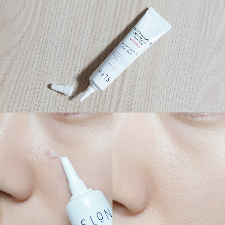  반복되는 코옆여드름 없애기 낫츠센텔라스카연고효과 후기