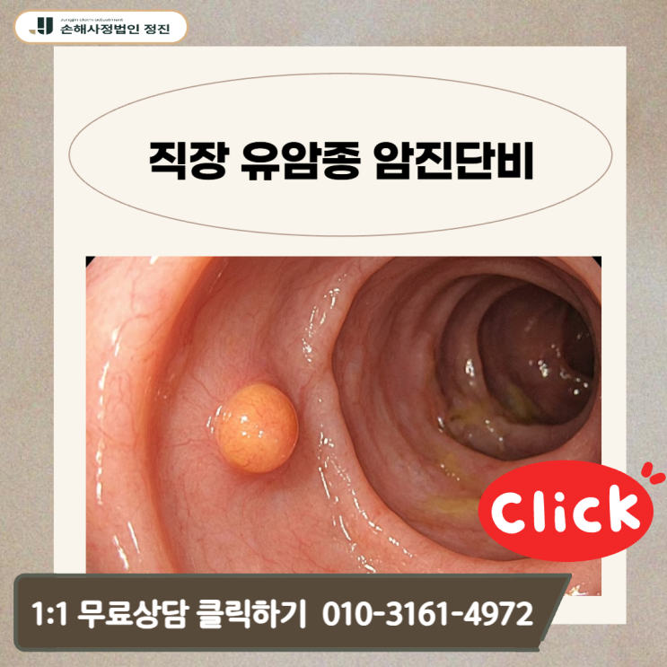  직장 유암종 암진단비, 유사암이라더니 일반암으로 뒤집힌 결정적 이유