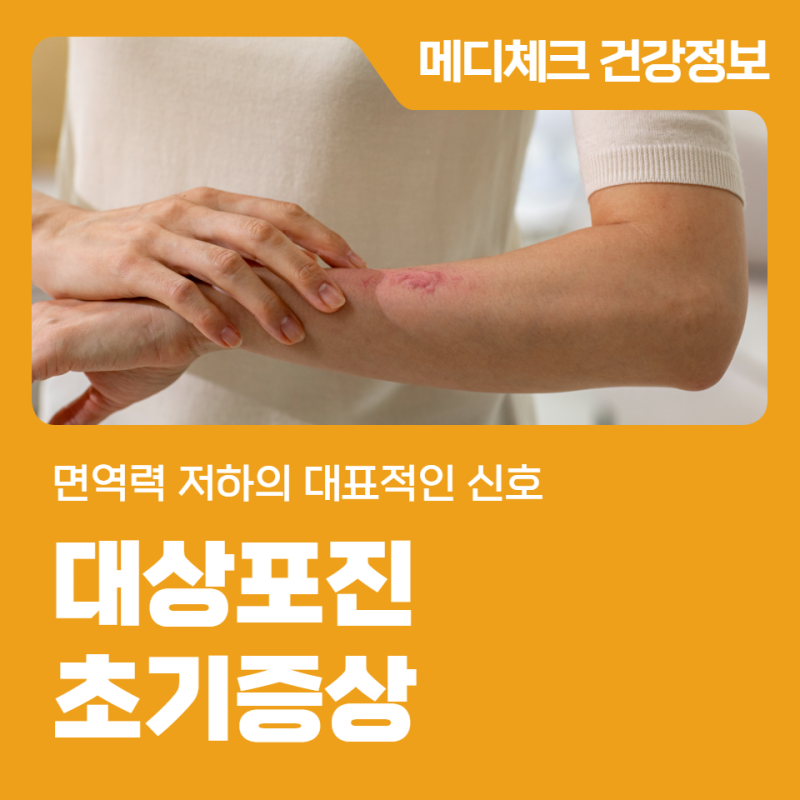 대상포진 초기증상 면역력 저하의 대표적인 신호