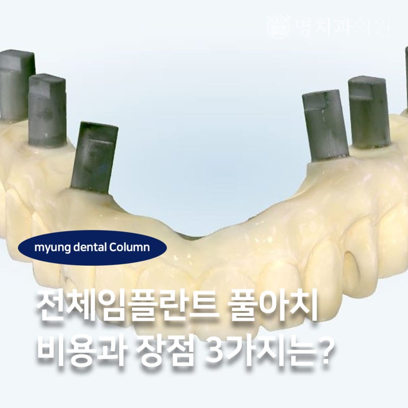 경산 전체임플란트 풀아치 비용과 장점 3가지는?