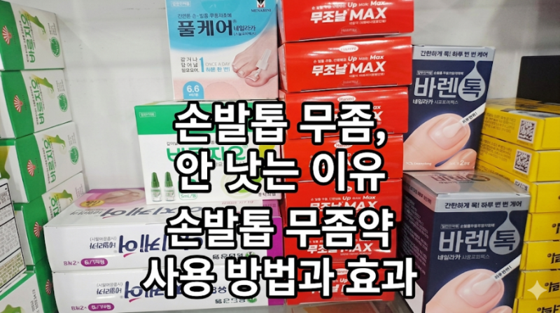 약국 꿀팁 ) 손발톱 무좀, 약 발라도 안 낫는 이유 : 약사가 알려주는 손발톱 무좀약, 바르는 ....