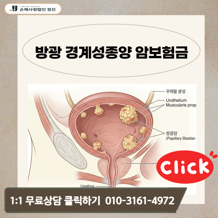  방광 경계성종양 암보험금, 왜 누구는 일반암 받고 누구는 못 받을까?