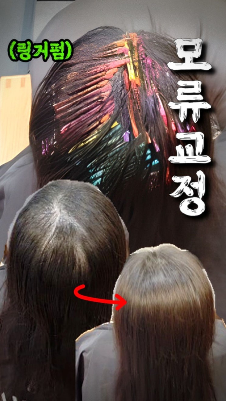  용인 모류교정 후기, 수지·죽전·광교까지 찾는 뿌리 볼륨 해결법