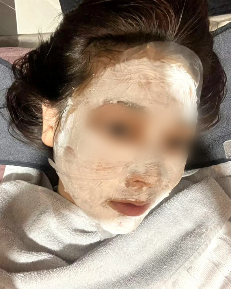 리쥬란팩 시술 전 꼭 알아야 할 효과와 부작용
