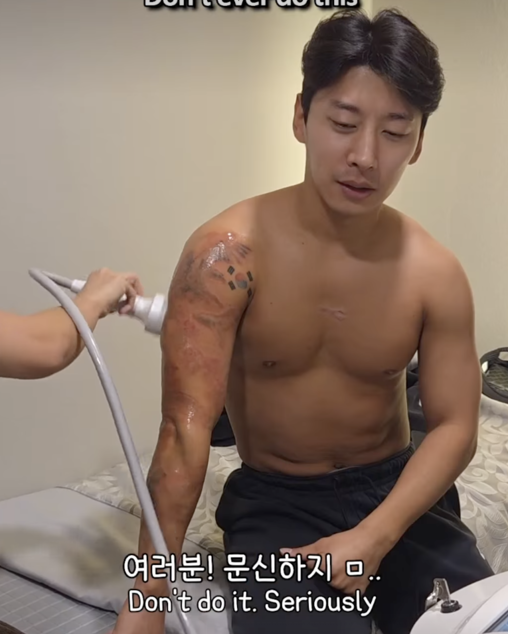 "문신 절대 하지 마세요" 곽윤기, 3년째 제거 중 밝힌 긴팔 생활 고백