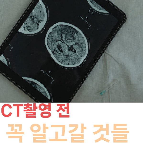 CT촬영 전 꼭 알아야 할 것들, 방사선 피폭·조영제 부작용·비용·주의사항 총정리