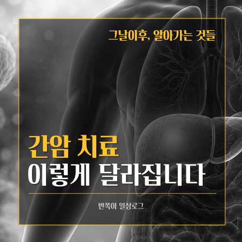 [간암]간암 치료 방법 종류 총정리｜수술·색전술·표적항암제 최신 치료까지