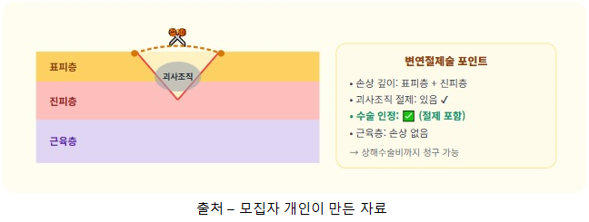 꿰맸는데 상해수술비가 안 나온다고요? 창상봉합술 변연절제술 근봉합술의 차이를 알면 해....