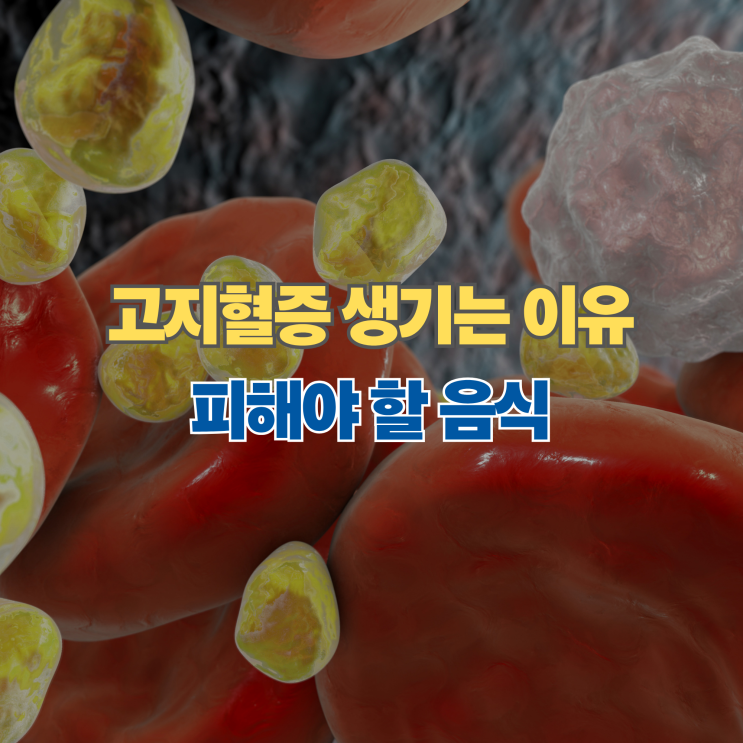  고지혈증 생기는 이유, 피해야 할 음식과 좋은 음식