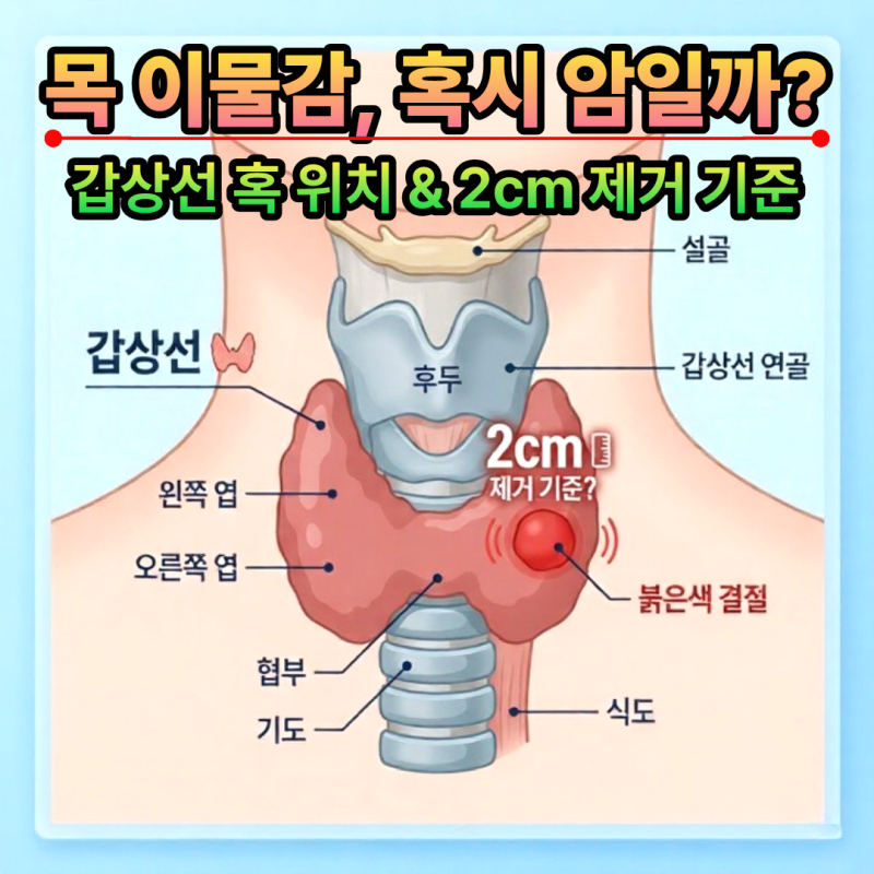 갑상선 혹 위치 확인 법과 2cm 이상 결절 제거 수술 기준 정리