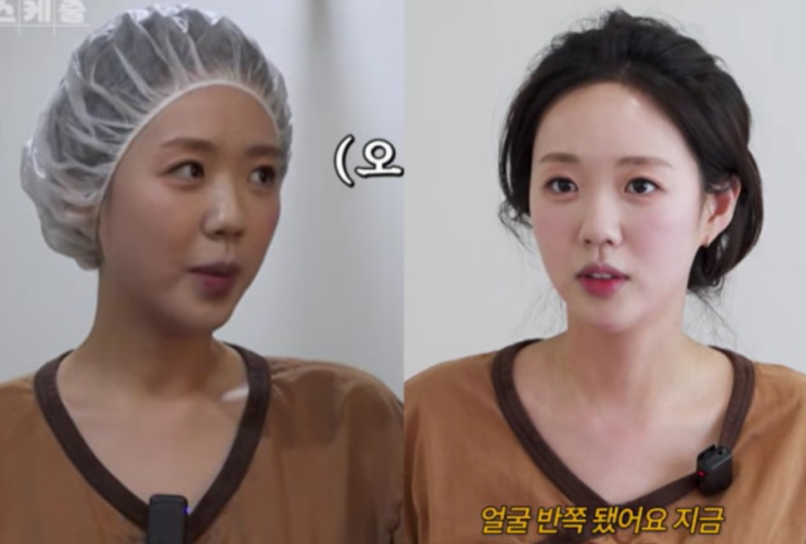   지예은 효소 찜질 후기! 얼굴 반쪽 된 비결과 6만 원의 행복