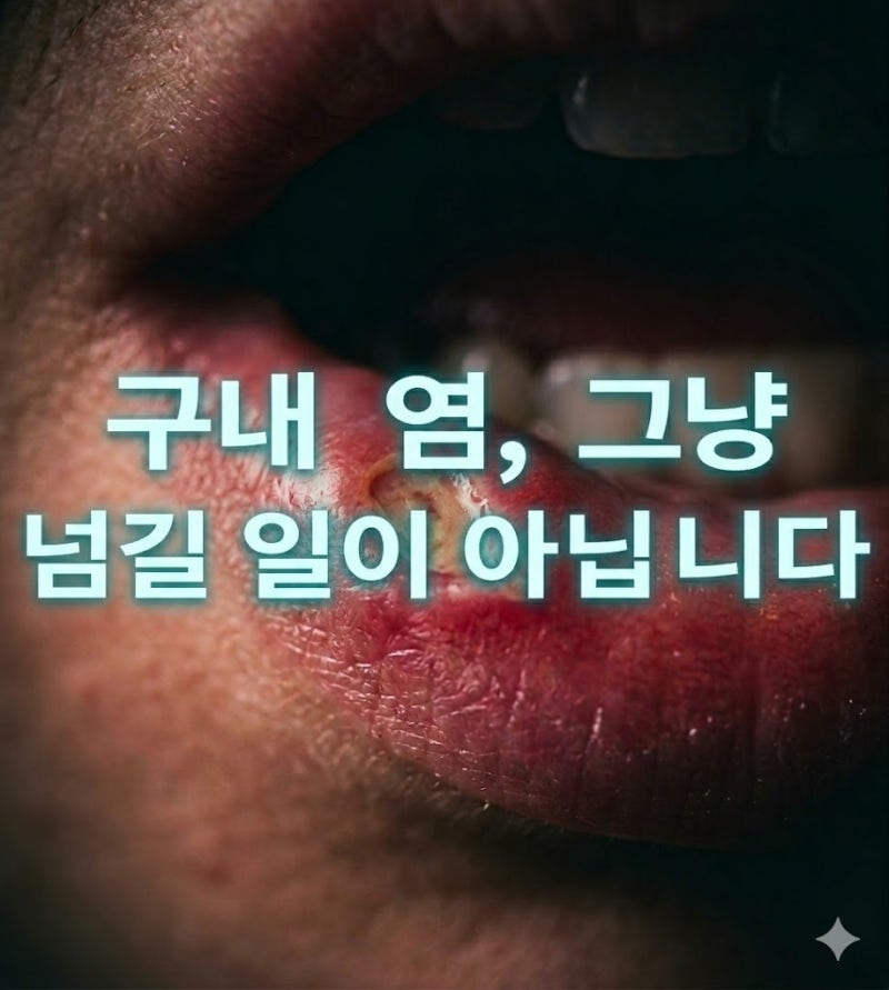 구내염이 2주 넘게 낫지 않는다면? 원인·증상·치료법 한 번에 정리했습니다