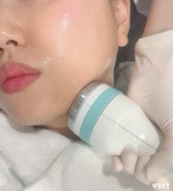  강남역온다리프팅 6만줄후기및 통증 후기
