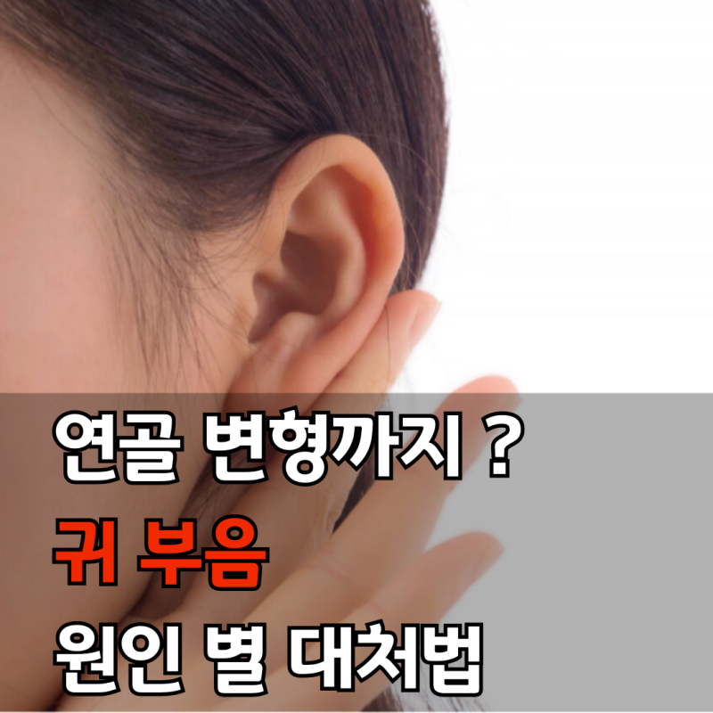 귀 부음 증상 방치하면 연골 변형까지? 원인별 대처법 3가지 정리