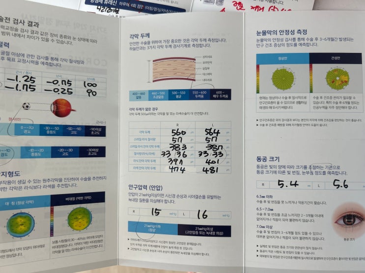  아마리스레드 코웨이브 라섹 검사&당일수술 후기 (ㅎㄴ안과)