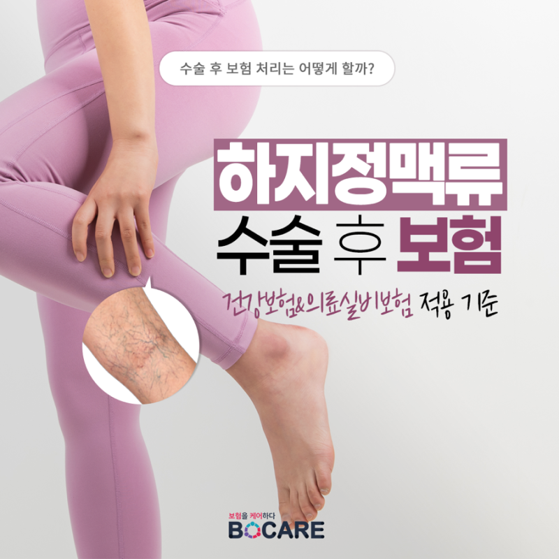 [알쓸신잡] 하지정맥류 수술 실비보험 될까? 건강보험 적용 기준 총정리