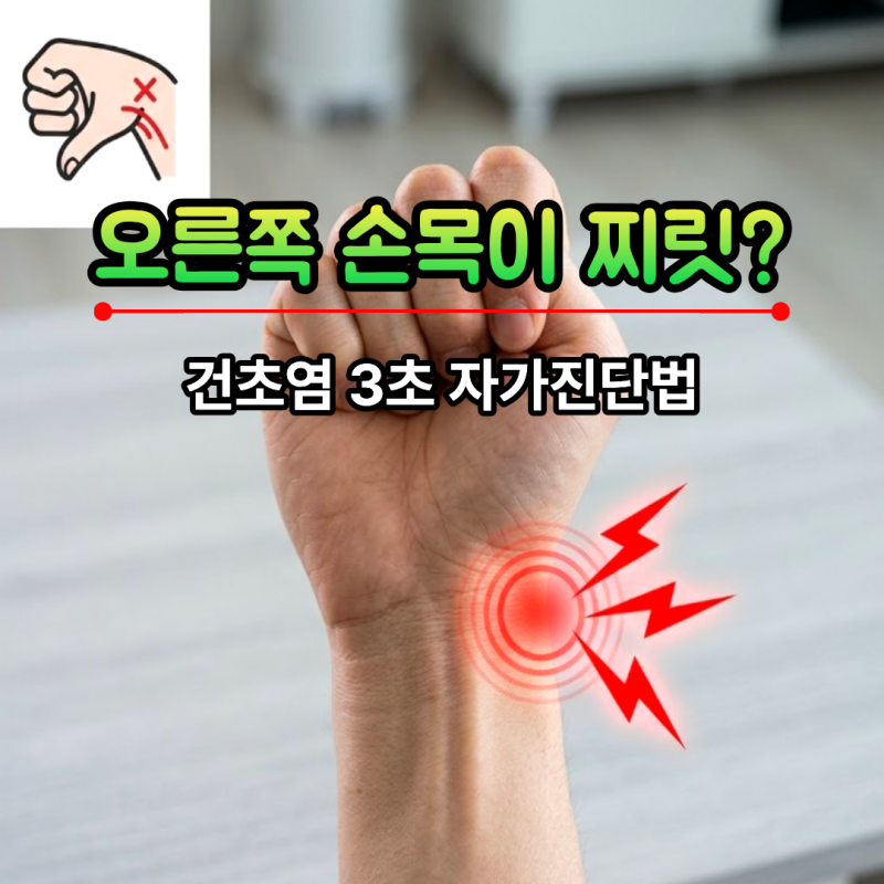 오른쪽 손목 통증, 건초염일까? 3초 자가진단법과 스트레칭 완화법 총정리