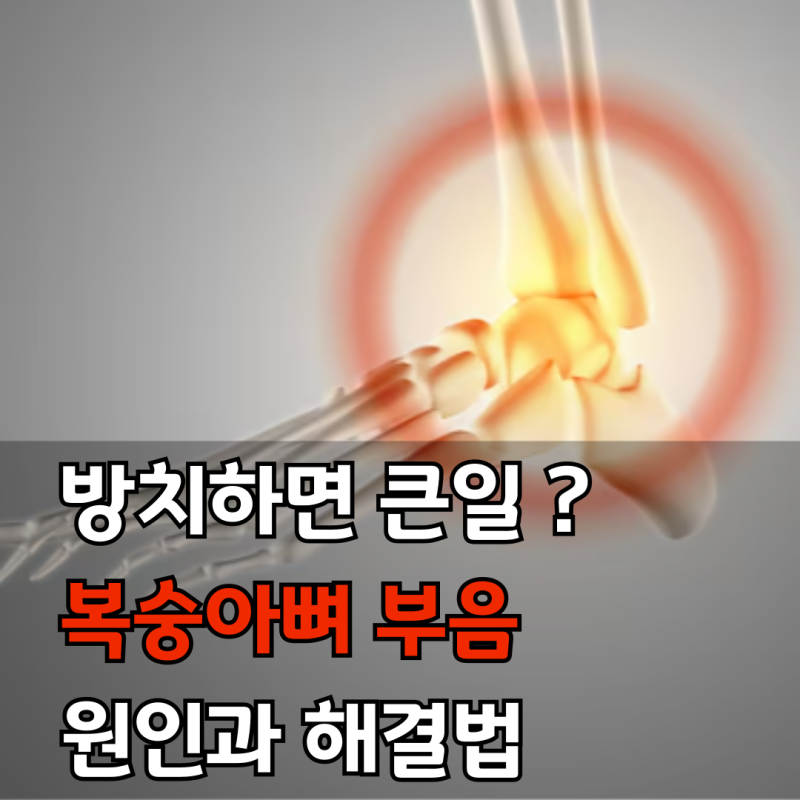 복숭아뼈 부음 방치하면 큰일? 가만히두지 마세요 원인부터 해결법까지 완벽정리
