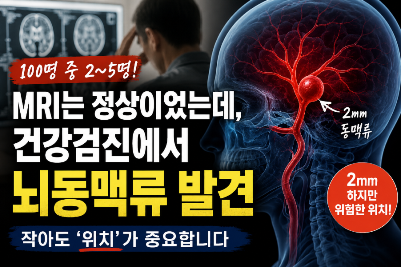 "MRI는 괜찮다 했는데… 뇌동맥류가 발견됐습니다"
