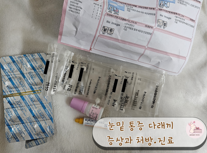 눈밑통증 다래끼 초기증상 진료.처방 후기