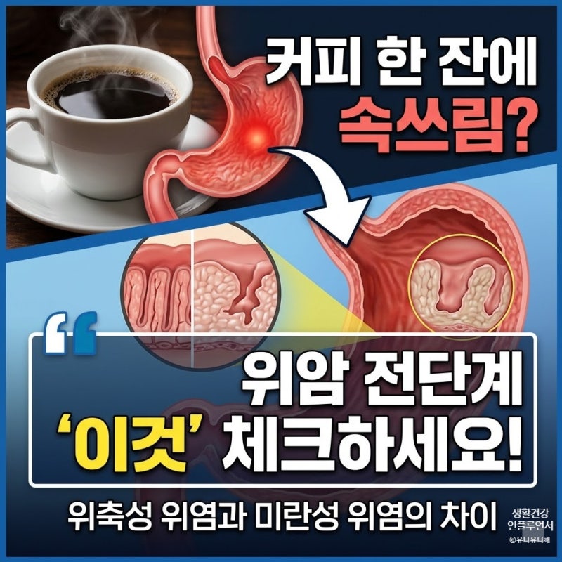 커피 속쓰림 있다? 위축성 미란성 위염 증상 차이와 관리법 총정리