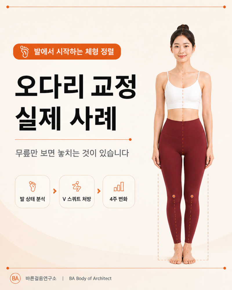 오다리 교정 실제 사례로본 카드뉴스 바른걸음연구소 BA 전문가