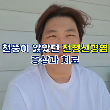 천뚱이 앓았던 전정신경염, 증상과 치료
