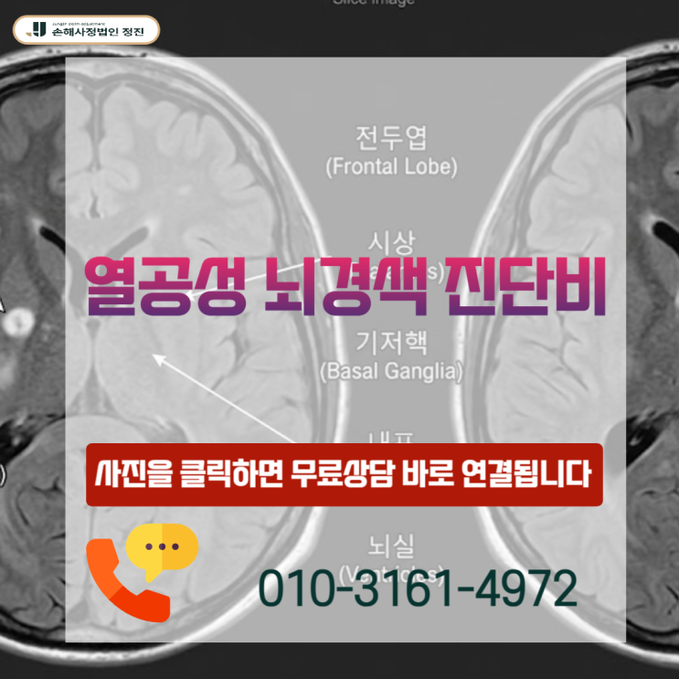  열공성 뇌경색 진단비, I63 코드 보험금 분쟁의 결정적 반전 포인트