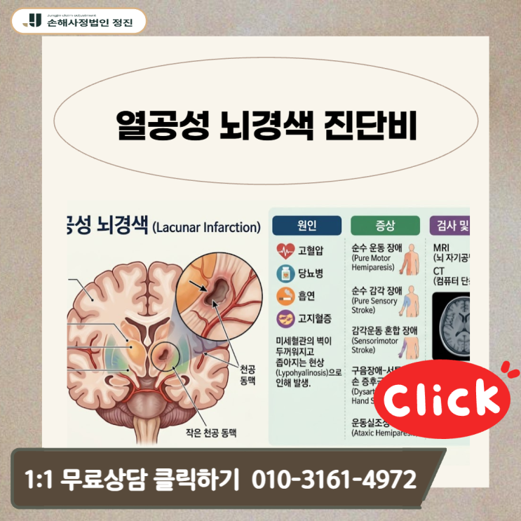  열공성 뇌경색 진단비, 거절 통보 후에도 인정받은 핵심 포인트