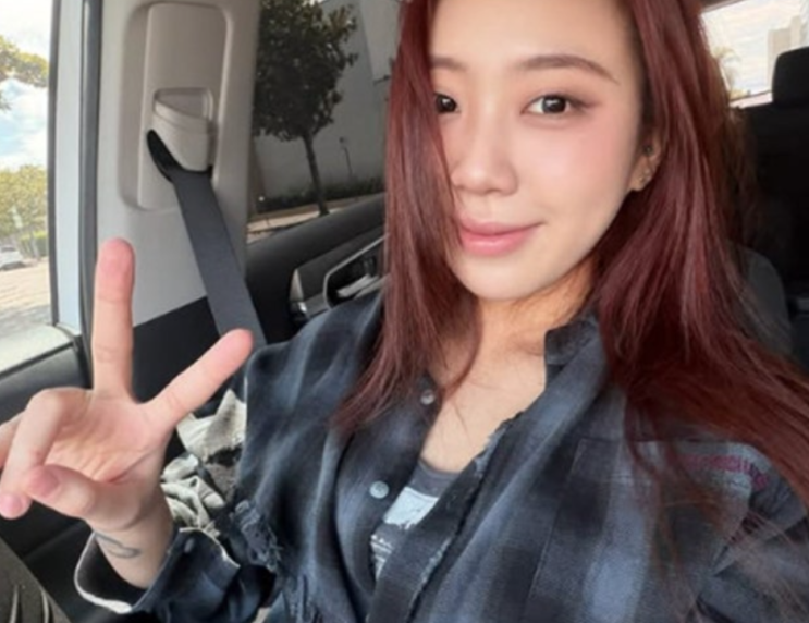   래퍼 이영지 눈 밑 지방 재배치 고백에 난리 난 비주얼 근황