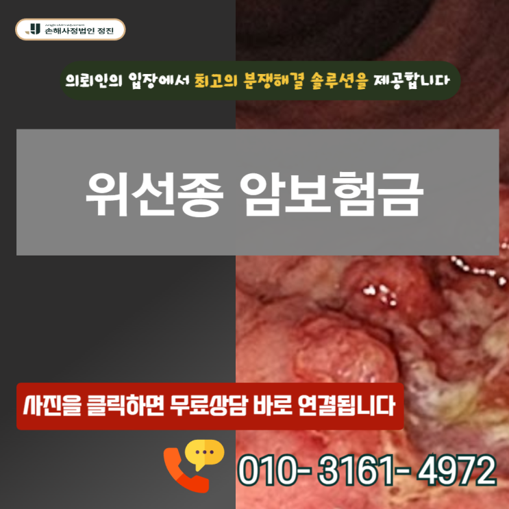  위선종 암보험금, D13.1 코드라도 포기하면 안 되는  이유