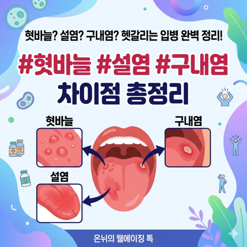 혓바늘, 설염, 구내염 뭐가 다를까? 증상부터 관리법까지 한 번에 정리