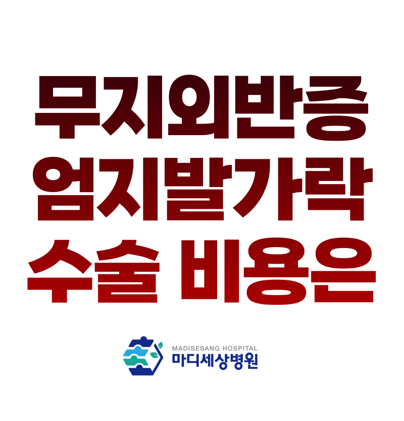 무지외반증 치료방법과 함께 알아보는 무지외반증 가격은
