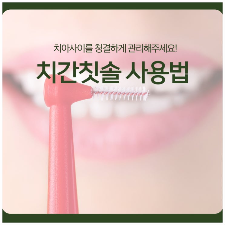  치간칫솔 사용법, 치아사이를 청결하게 관리해주세요!