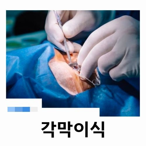 각막이식 시력을 되찾는 마지막 선택일까? 회복기간
