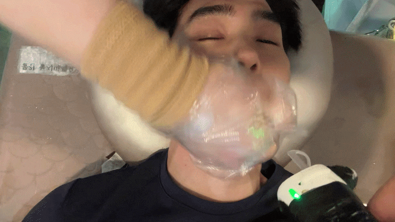 부천남자레이저제모 | 부천피부과에서 여름맞이 남자 수염 제모 깔끔하게