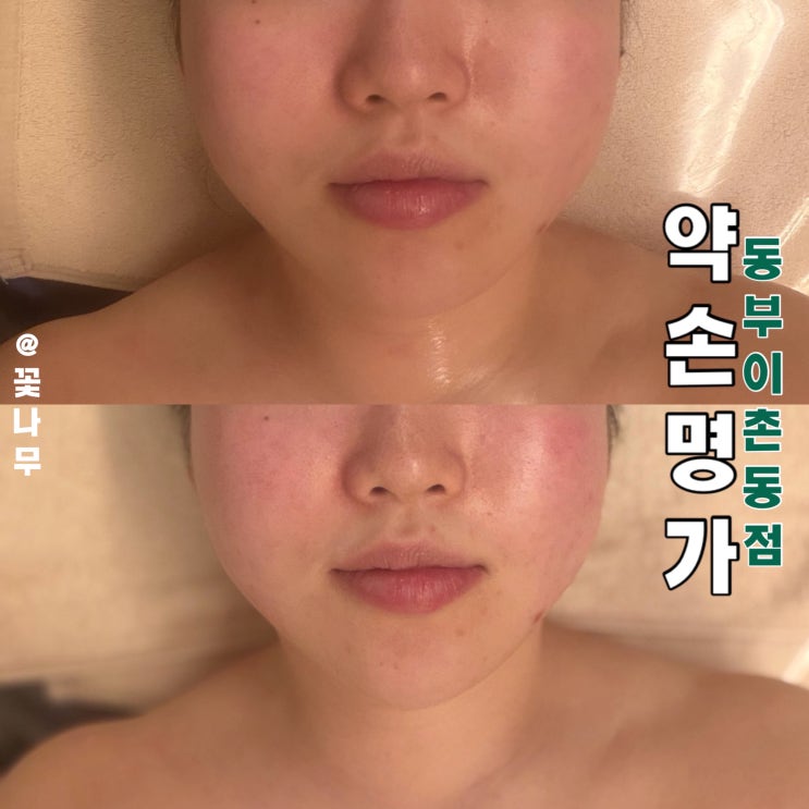  약손명가 처돌이가 말아주는 용산 에스테틱 약손명가 동부이촌동점 후기