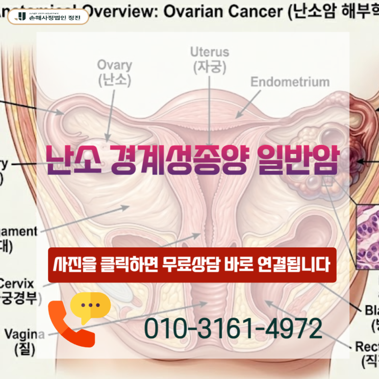  난소 경계성종양 암보험금, 포기 직전 뒤집힌 실제 보상 핵심