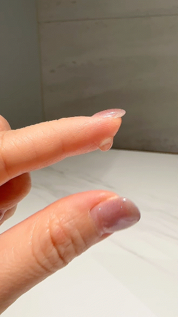 울긋불긋한 반복되는 트러블 때문에 써본 여드름 앰플✨ 청소년 여드름 화장품 살림백서 제....