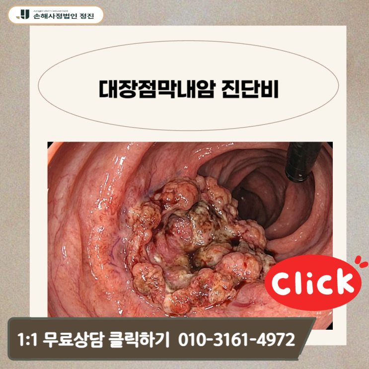  대장점막내암 진단비, 보험사가 숨기는 90%의 진실을 찾아서