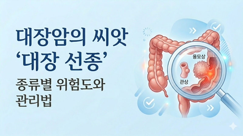 대장내시경 후 발견된 '대장 선종', 종류별 악성도와 치료·관리법